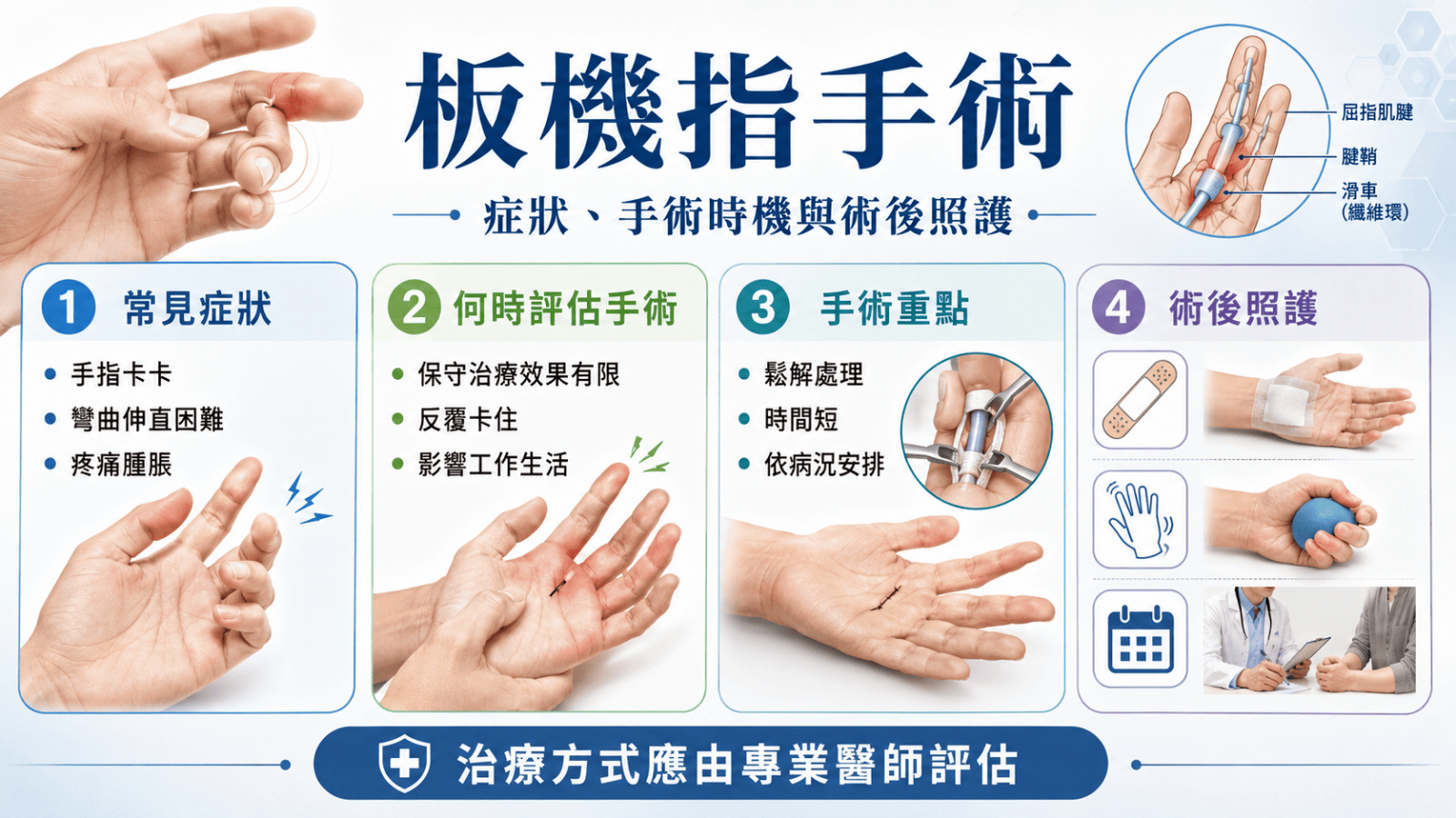 板機指是常見的手部問題之一，典型症狀包含手指卡住